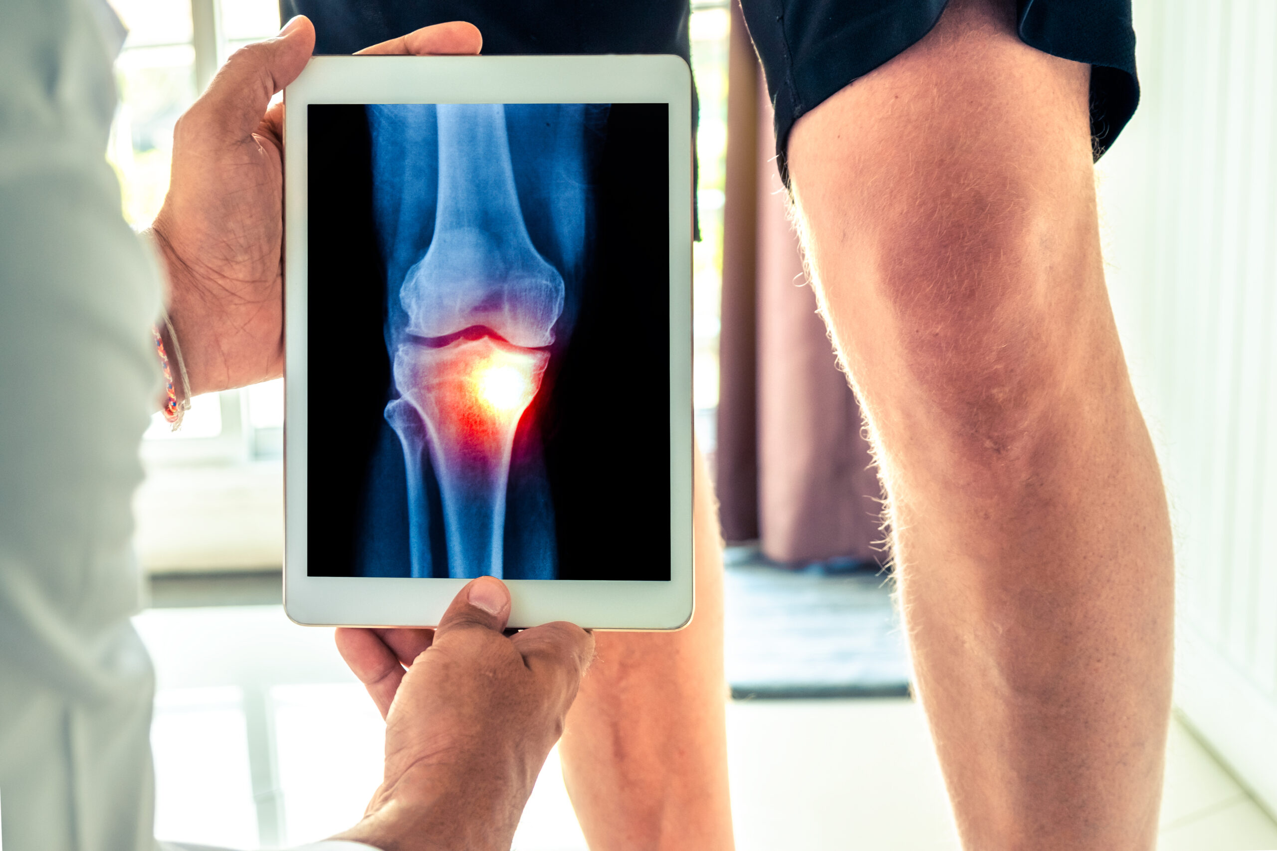 Common causes of knee pain and the role of Medical Yoga Therapy to cure it