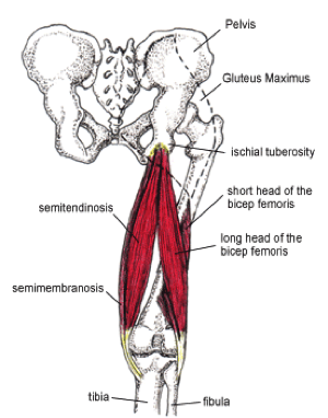 Hamstring Tightness: The Hidden Cause of Knee and Low Back Pain